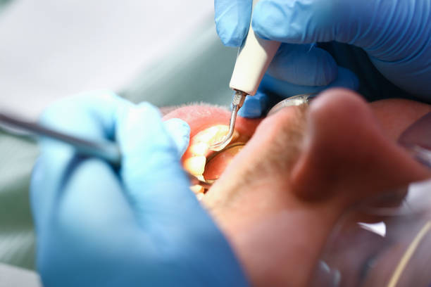 Best Mobile Emergency Dentist in Pontotoc, MS